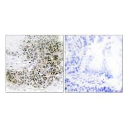 Immunohistochemistry - TRPS1 Antibody from Signalway Antibody (34103) - Antibodies.com