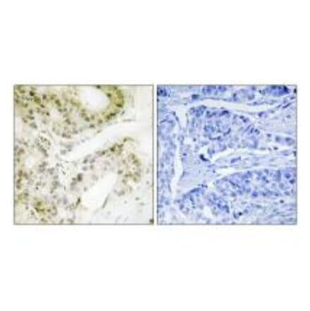 Immunohistochemistry - MED13 Antibody from Signalway Antibody (34107) - Antibodies.com