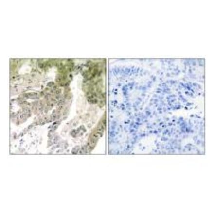 Immunohistochemistry - LAMA5 Antibody from Signalway Antibody (34275) - Antibodies.com