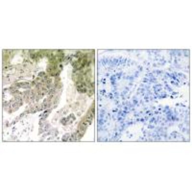 Immunohistochemistry - LAMA5 Antibody from Signalway Antibody (34275) - Antibodies.com