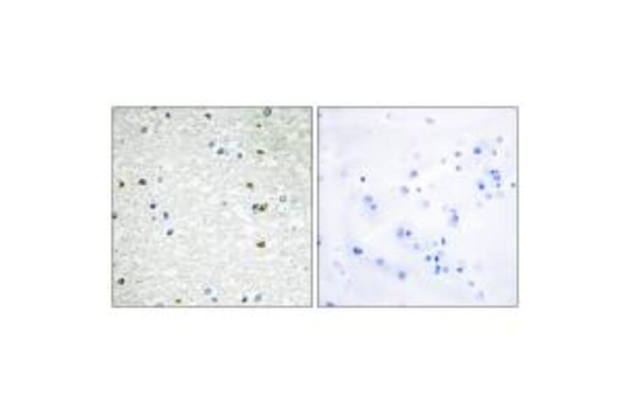 Immunohistochemistry - PARP3 Antibody from Signalway Antibody (34293) - Antibodies.com