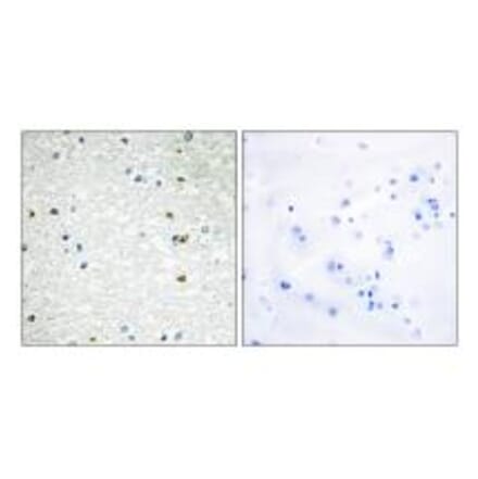 Immunohistochemistry - PARP3 Antibody from Signalway Antibody (34293) - Antibodies.com