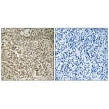 Immunohistochemistry - RPL40 Antibody from Signalway Antibody (34362) - Antibodies.com