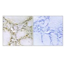 Immunohistochemistry - AMPD1 Antibody from Signalway Antibody (34409) - Antibodies.com