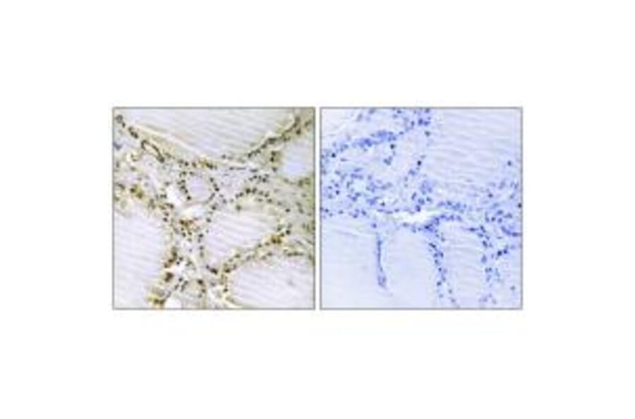 Immunohistochemistry - AMPD1 Antibody from Signalway Antibody (34409) - Antibodies.com