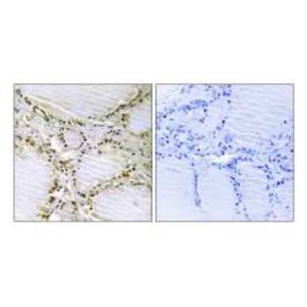 Immunohistochemistry - AMPD1 Antibody from Signalway Antibody (34409) - Antibodies.com