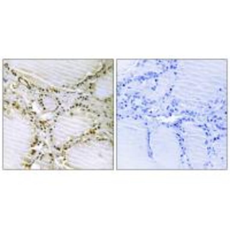 Immunohistochemistry - AMPD1 Antibody from Signalway Antibody (34409) - Antibodies.com