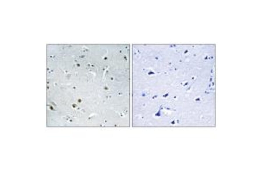 Immunohistochemistry - DDX24 Antibody from Signalway Antibody (34466) - Antibodies.com