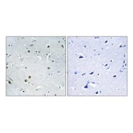 Immunohistochemistry - DDX24 Antibody from Signalway Antibody (34466) - Antibodies.com