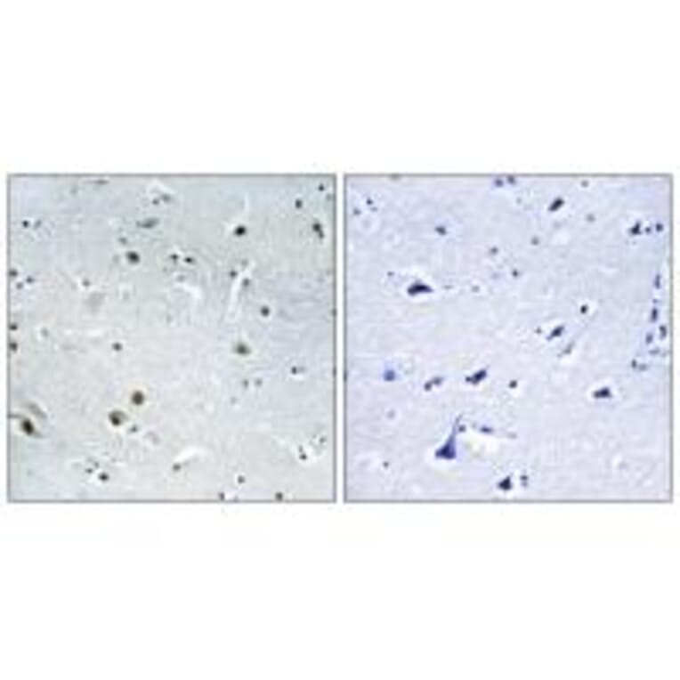Immunohistochemistry - DDX24 Antibody from Signalway Antibody (34466) - Antibodies.com
