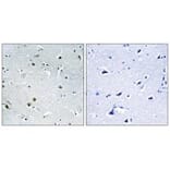 Immunohistochemistry - DDX24 Antibody from Signalway Antibody (34466) - Antibodies.com