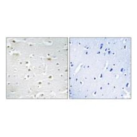 Immunohistochemistry - DDX3Y Antibody from Signalway Antibody (34467) - Antibodies.com