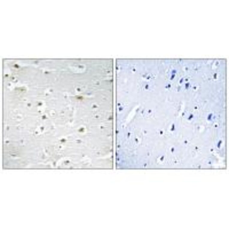 Immunohistochemistry - DDX3Y Antibody from Signalway Antibody (34467) - Antibodies.com