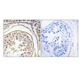 Immunohistochemistry - BAGE2 Antibody from Signalway Antibody (34475) - Antibodies.com