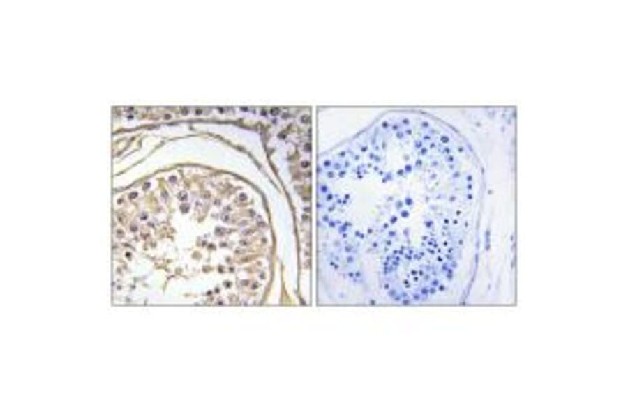 Immunohistochemistry - BAGE2 Antibody from Signalway Antibody (34475) - Antibodies.com