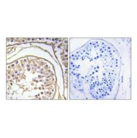 Immunohistochemistry - BAGE2 Antibody from Signalway Antibody (34475) - Antibodies.com