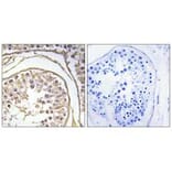 Immunohistochemistry - BAGE2 Antibody from Signalway Antibody (34475) - Antibodies.com