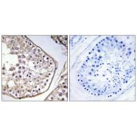 Immunohistochemistry analysis of paraffin-embedded human testis tissue using BAGE3 antibody #34476.