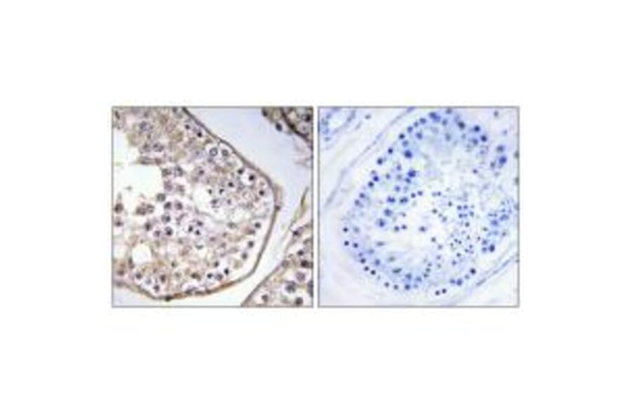 Immunohistochemistry - BAGE3 Antibody from Signalway Antibody (34476) - Antibodies.com