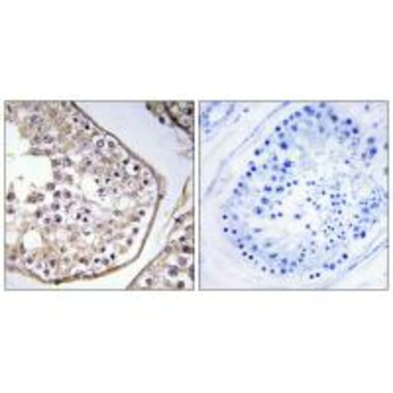 Immunohistochemistry - BAGE3 Antibody from Signalway Antibody (34476) - Antibodies.com