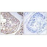 Immunohistochemistry - BAGE3 Antibody from Signalway Antibody (34476) - Antibodies.com