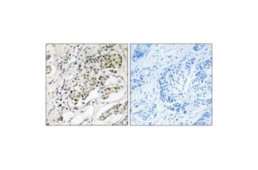 Immunohistochemistry - CDYLy2 Antibod from Signalway Antibody (34590) - Antibodies.com