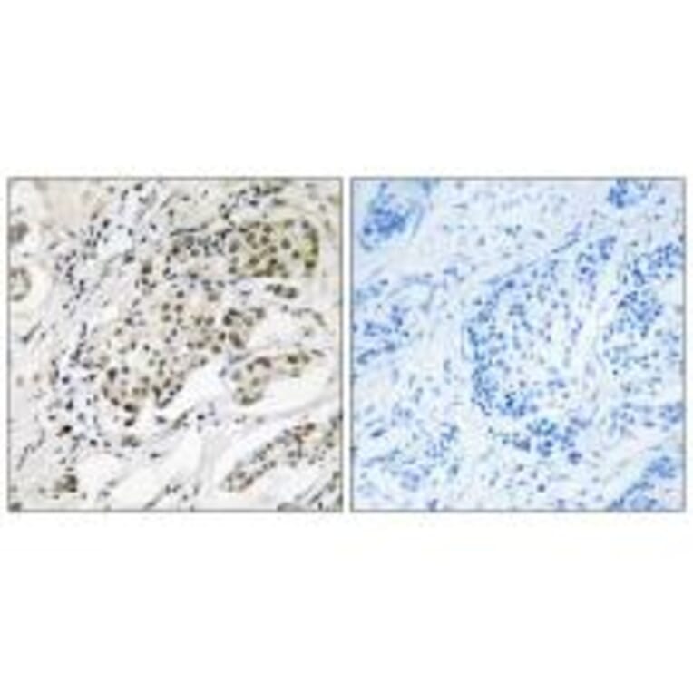 Immunohistochemistry - CDYLy2 Antibod from Signalway Antibody (34590) - Antibodies.com