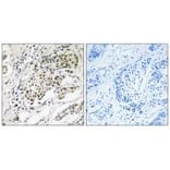 Immunohistochemistry - CDYLy2 Antibod from Signalway Antibody (34590) - Antibodies.com