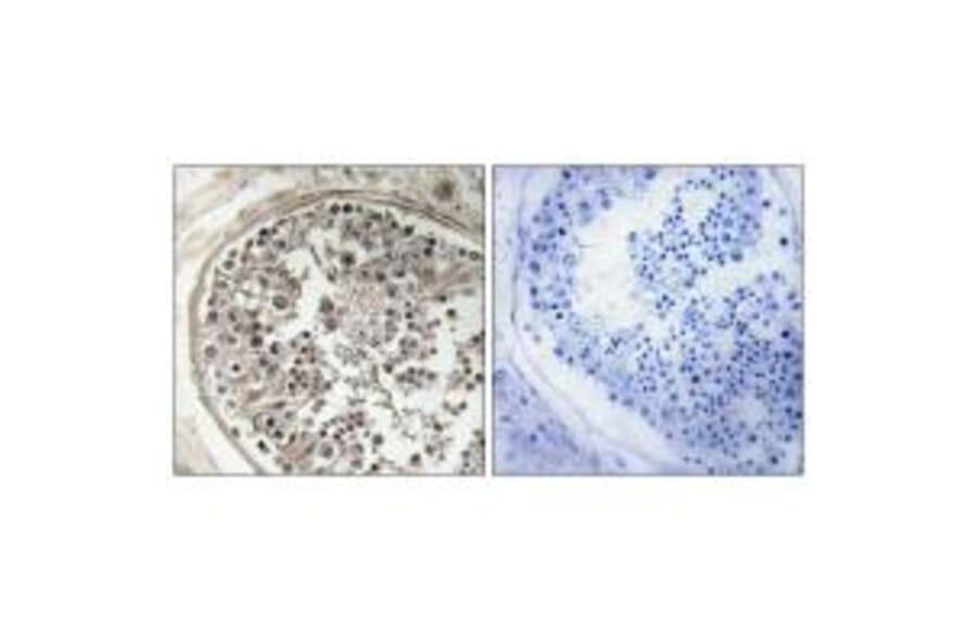 Immunohistochemistry - MRPS5 Antibody from Signalway Antibody (34798) - Antibodies.com