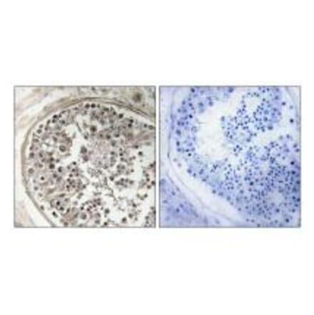 Immunohistochemistry - MRPS5 Antibody from Signalway Antibody (34798) - Antibodies.com