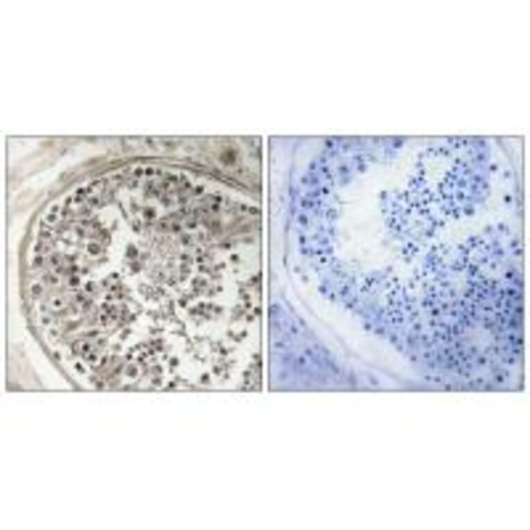 Immunohistochemistry - MRPS5 Antibody from Signalway Antibody (34798) - Antibodies.com