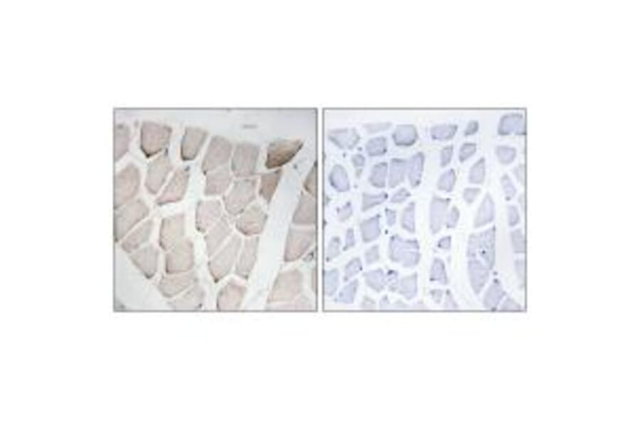 Immunohistochemistry - MYOM1 Antibody from Signalway Antibody (34816) - Antibodies.com
