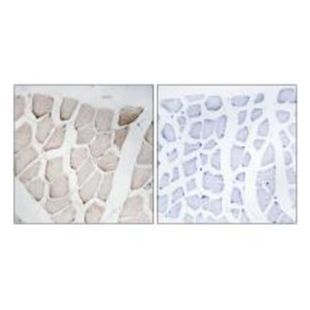 Immunohistochemistry - MYOM1 Antibody from Signalway Antibody (34816) - Antibodies.com