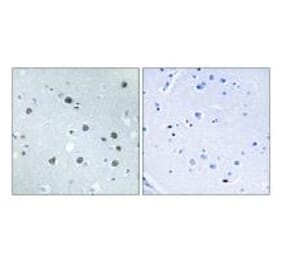 Immunohistochemistry - MYO1D Antibody from Signalway Antibody (34822) - Antibodies.com