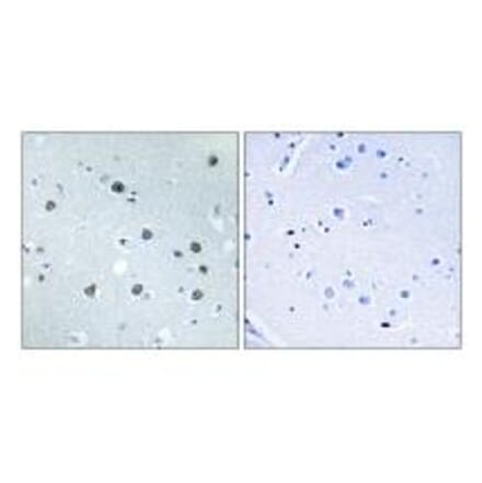 Immunohistochemistry - MYO1D Antibody from Signalway Antibody (34822) - Antibodies.com