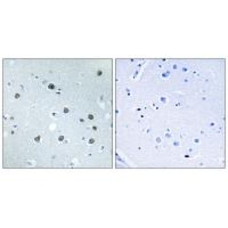 Immunohistochemistry - MYO1D Antibody from Signalway Antibody (34822) - Antibodies.com