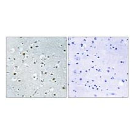 Immunohistochemistry - PPRC1 Antibody from Signalway Antibody (34898) - Antibodies.com