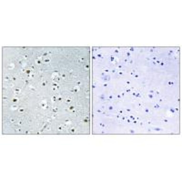 Immunohistochemistry - PPRC1 Antibody from Signalway Antibody (34898) - Antibodies.com