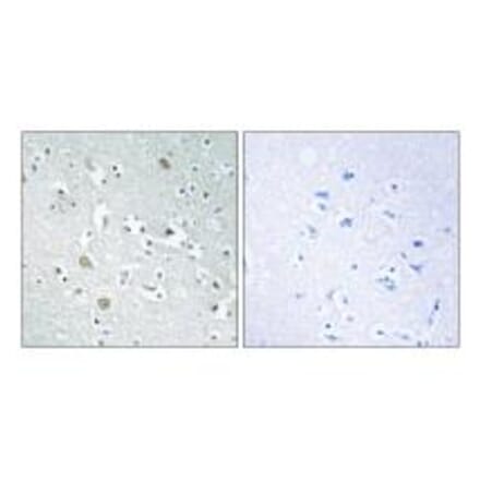 Immunohistochemistry - PLA1A Antibody from Signalway Antibody (34904) - Antibodies.com