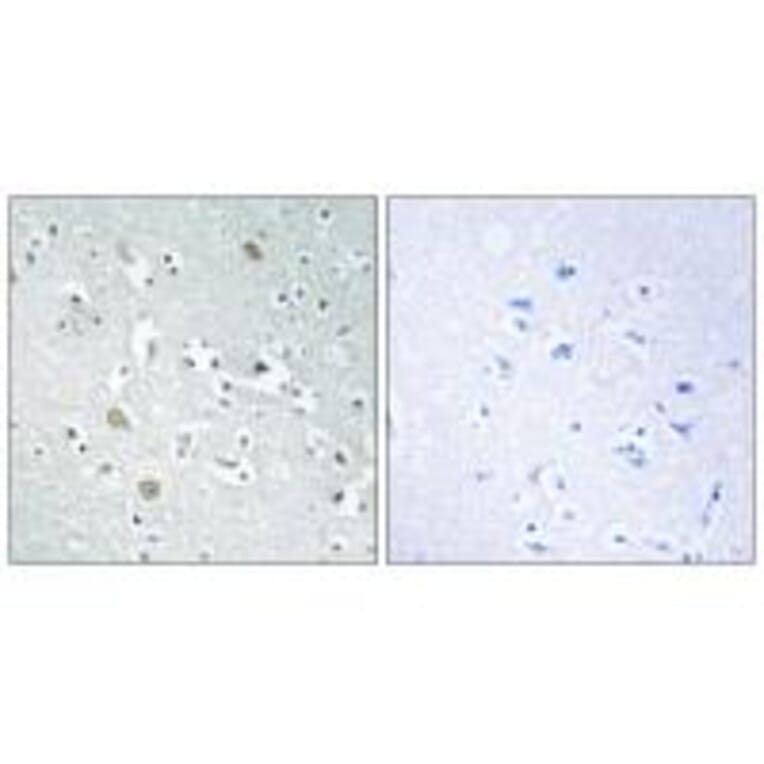 Immunohistochemistry - PLA1A Antibody from Signalway Antibody (34904) - Antibodies.com