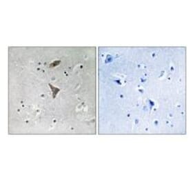 Immunohistochemistry - KCNT1 Antibody from Signalway Antibody (34913) - Antibodies.com