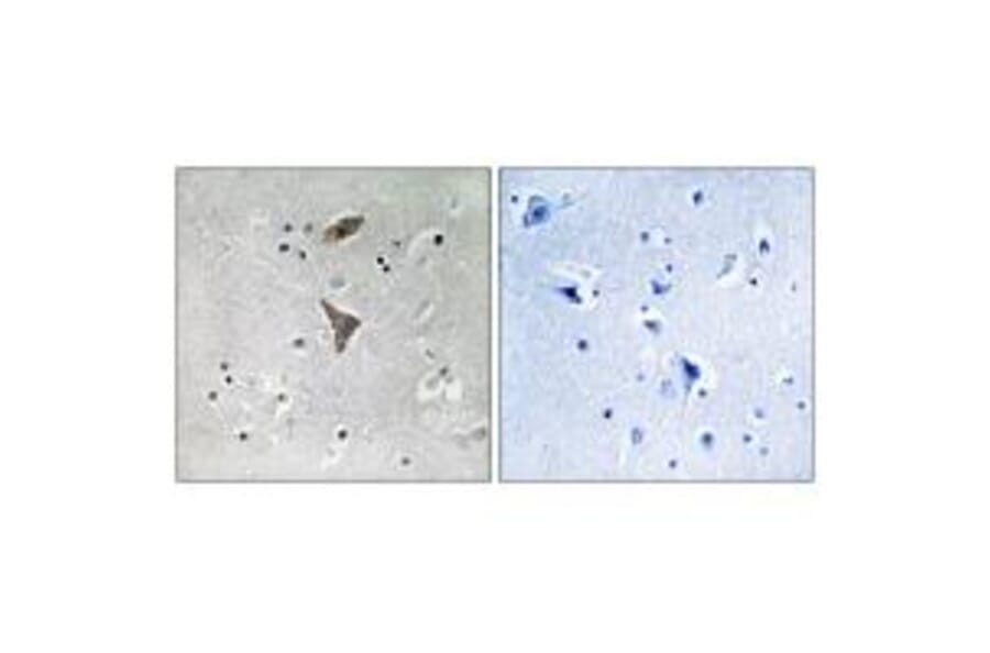 Immunohistochemistry - KCNT1 Antibody from Signalway Antibody (34913) - Antibodies.com