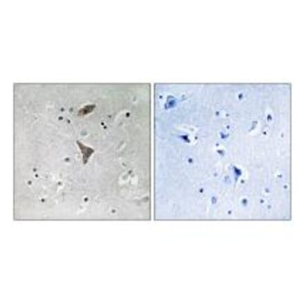 Immunohistochemistry - KCNT1 Antibody from Signalway Antibody (34913) - Antibodies.com