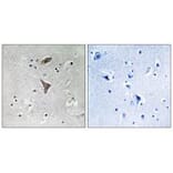 Immunohistochemistry - KCNT1 Antibody from Signalway Antibody (34913) - Antibodies.com