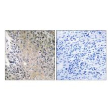 Immunohistochemistry - RAB41 Antibody from Signalway Antibody (34971) - Antibodies.com