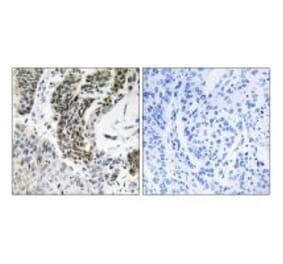 Immunohistochemistry - RREB1 Antibody from Signalway Antibody (34975) - Antibodies.com