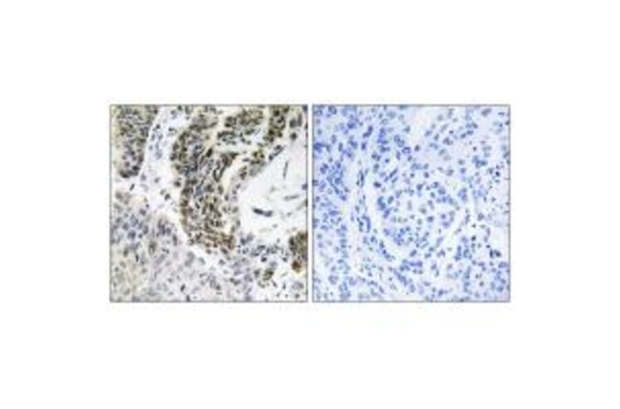 Immunohistochemistry - RREB1 Antibody from Signalway Antibody (34975) - Antibodies.com