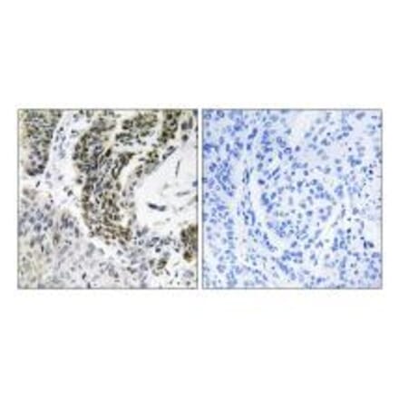 Immunohistochemistry - RREB1 Antibody from Signalway Antibody (34975) - Antibodies.com