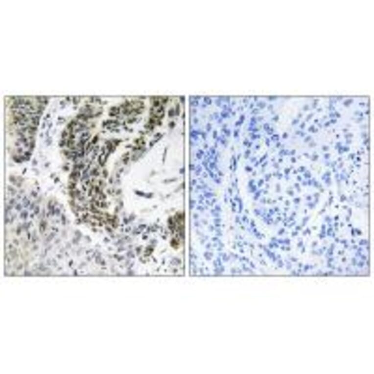Immunohistochemistry - RREB1 Antibody from Signalway Antibody (34975) - Antibodies.com