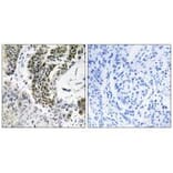 Immunohistochemistry - RREB1 Antibody from Signalway Antibody (34975) - Antibodies.com